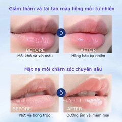 [UK] Son Dưỡng Môi Vaseline Lip Therapy Rosy Hộp Thiếc Màu Hồng 20g