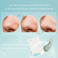 [ILSO] Cây Nặn Mụn Đầu Đen ILSO chuyên dụng Deep Clean Master giúp đẩy & lấy mụn đầu đen dễ dàng