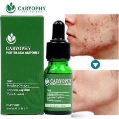 Serum Tinh Chất Caryophy Giảm Mụn Mờ Thâm Se Lỗ Chân Lông 30ml - [Mẫu Mới]