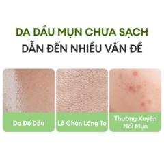 Mặt Nạ Bùn Trà Xanh Dành Cho Da Dầu Mụn Colorkey Luminous Green Tea Purifying Clay Mask 60g