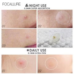 [FOCALLURE] Miếng Dán Mụn FOCALLURE Siêu Mỏng Trong Suốt Không Thấm Nước, Hỗ Trợ Giảm Sưng Viêm 24 miếng (FA186)