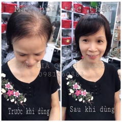 Tóc Giả Phủ Hói Phủ Bạc Đỉnh Đầu Có Mái 4D Cao Cấp – Mái Che Đỉnh Tự Nhiên, Tơ Mềm Như Tóc Thật, Kẹp Chắc Không Lộ