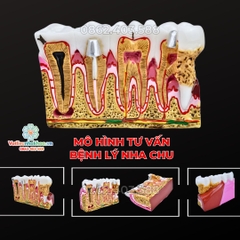 Mô hình tư vấn bệnh lý nha chu