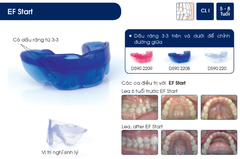 Hàm định hình khớp răng EF Line Orthoplus