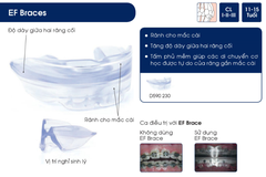 Hàm định hình khớp răng EF Line Orthoplus