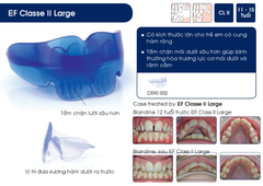 Hàm định hình khớp răng EF Line Orthoplus