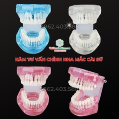 Hàm tư vấn chỉnh nha mắc cài sứ