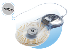 Thiết Bị Cấy Trong CS-10A