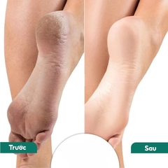 Kem Mềm Da Nail Xina – Dưỡng Mềm Da Tay, Da Móng Thơm Dịu