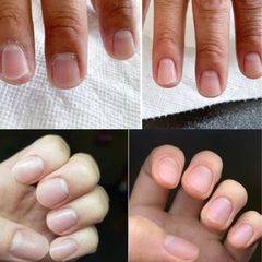 Kem Mềm Da Blue Cross Cuticle Remover 177ml