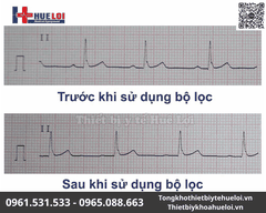 Máy điện tim 6 kênh Contec-600G | Màn hình cảm ứng