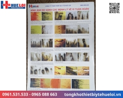 Kính hiển vi soi mạch máu XW880 | Máy soi vi tuần hoàn chính hãng