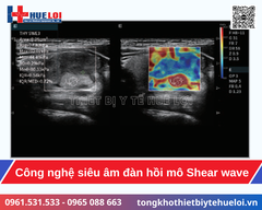 Hệ thống siêu âm bàn đẩy cao cấp Edan Acclarix LX85