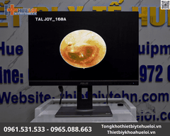 Máy Nội Soi Tai Mũi Họng SD TJ-168A | Huê Lợi