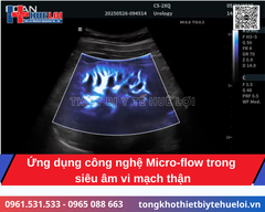 Hệ thống siêu âm bàn đẩy cao cấp Edan Acclarix LX85