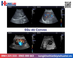 Máy siêu âm xách tay cao cấp EDAN AX3 (Acclarix AX3)