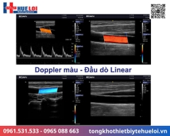Máy siêu âm xách tay cao cấp EDAN AX3 (Acclarix AX3)