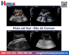 Máy siêu âm xách tay cao cấp EDAN AX3 (Acclarix AX3)