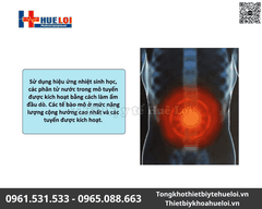 Máy trị liệu tuyến tiền liệt Sanwe - Giải pháp điều trị 3 trong 1 không xâm lấn