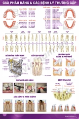 Tranh giải phẫu răng & các bệnh lý thường gặp