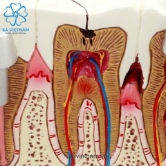 Mẫu hàm tư vấn bệnh lý