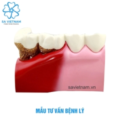 Mẫu hàm tư vấn bệnh lý