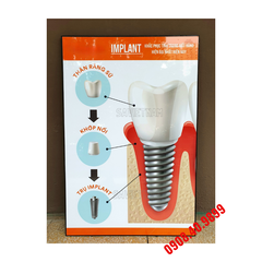 Tranh Implant nha khoa công nghệ cao - MS07