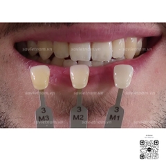 Bảng so màu răng VITA Toothguide 3D MASTER mẫu mới