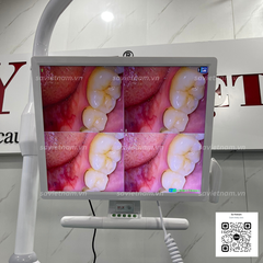 Bộ camera soi răng có wifi DYM SKI-105