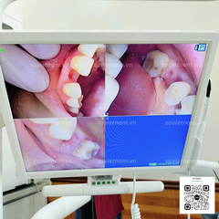 Bộ camera soi răng có wifi DYM SKI-105