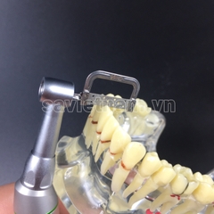 Bộ cưa kẽ máy (Cưa kẽ chỉnh nha)