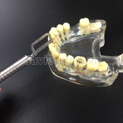 Bộ cưa kẽ máy (Cưa kẽ chỉnh nha)