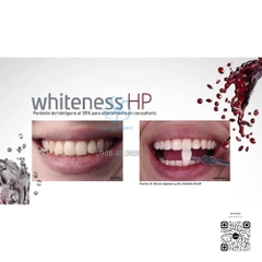 Thuốc Tẩy Trắng Răng Whiteness HP Maxx 35% FGM (Brazil) – Chính Hãng