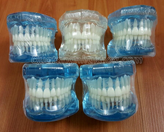 Mẫu Hàm Răng Bằng Nhựa Trong (Dùng gắn mắc cài, mài thẩm mỹ)