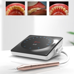 Máy cạo vôi Ultrasonic U6 Led Woodpecker - Máy lấy cao