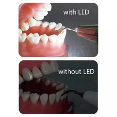 Máy lấy cao răng MaxPiezo 7+ Refine (máy cạo răng)