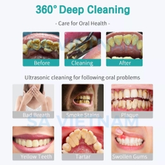 Máy lấy cao VRN - Trung Quốc (máy cạo vôi răng)