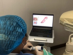 Máy quét trong miệng COXO Intra Oral Scanner - DL-300P (Máy scan Coxo)