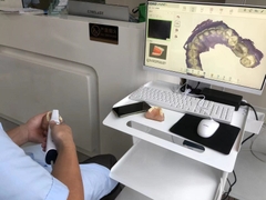 Máy quét trong miệng COXO Intra Oral Scanner - DL-300P (Máy scan Coxo)