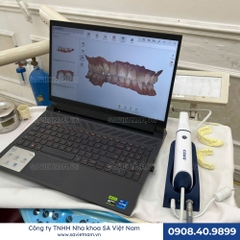 Máy quét trong miệng COXO Intra Oral Scanner - DL-300P (Máy scan Coxo)