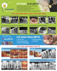 Vật liệu trám bít ống tủy OrthoMTA- Hàn Quốc