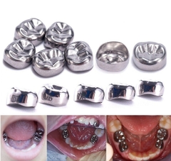 Chụp thép răng sữa Hàn Quốc - Chụp lẻ size