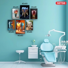 SET TRANH NHA KHOA -SET 58