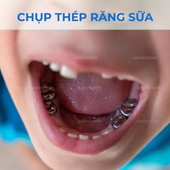 Chụp thép răng sữa Hàn Quốc - Chụp lẻ size