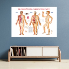 Tranh Châm cứu (Acupuncture paint)