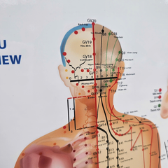 Tranh Châm cứu (Acupuncture paint)