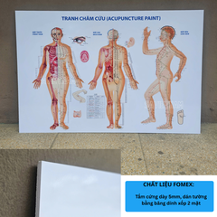 Tranh Châm cứu (Acupuncture paint)