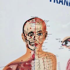 Tranh Châm cứu (Acupuncture paint)