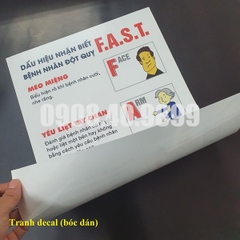 Tranh dấu hiệu nhận biết đột quỵ F.A.S.T