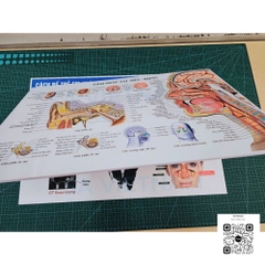 Tranh giải phẫu tai mũi họng - MS01